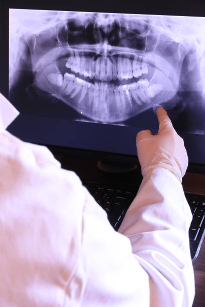Best Emergency Treatment for Oral Infections in Palos Park, IL
