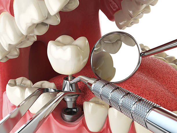 Professional Emergency Dental Service in IL